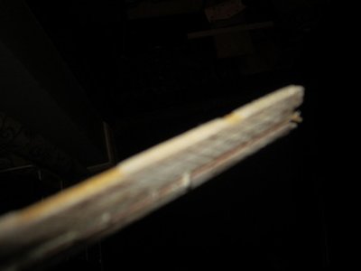 Veneer problems (blurry).jpg